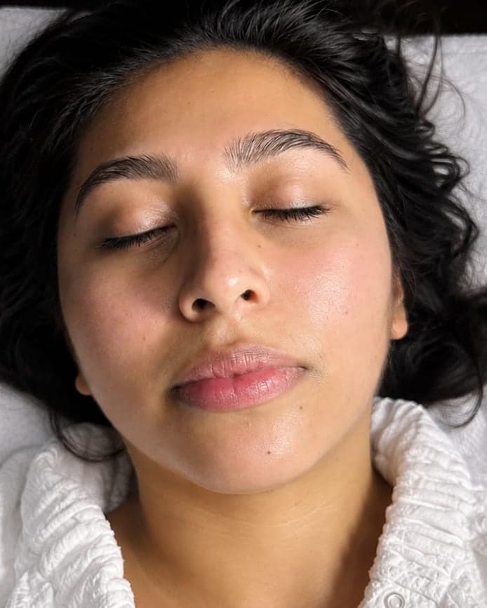 Immediately after: Dermaplaning + Nano-Infusion