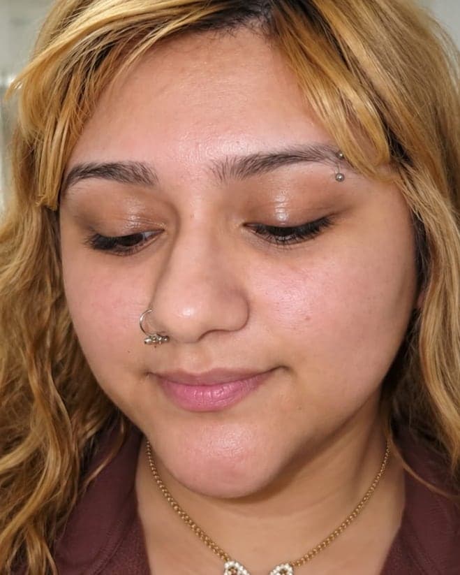 After 2 sessions: Dermaplaning + Nano-Infusion