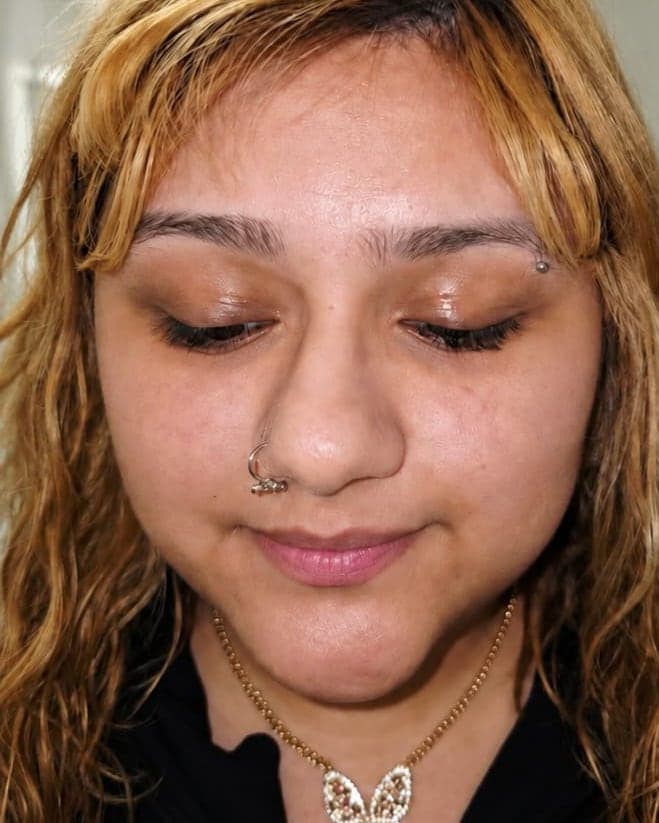 Before: Dermaplaning + Nano-Infusion