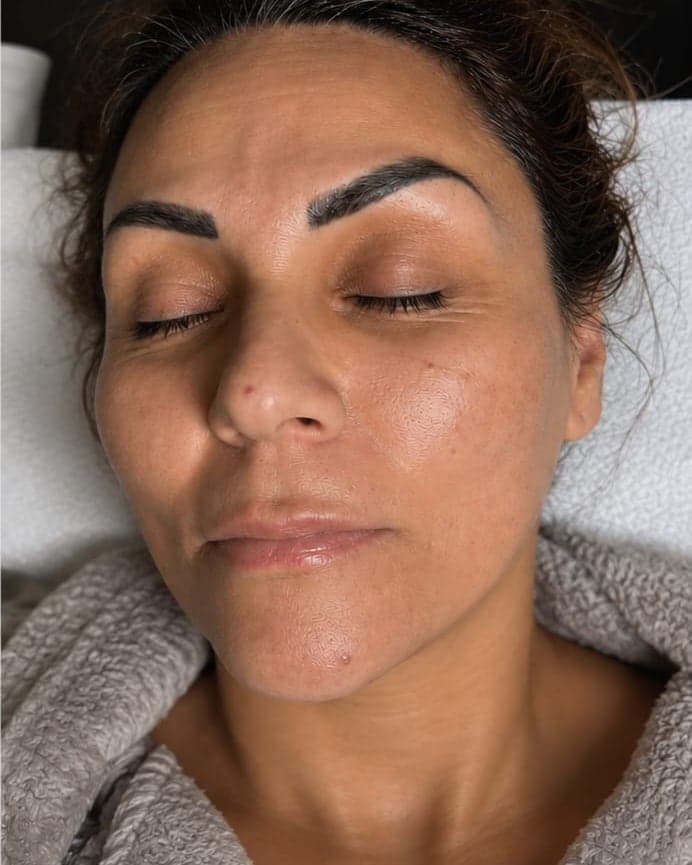 After: Nano-Infusion