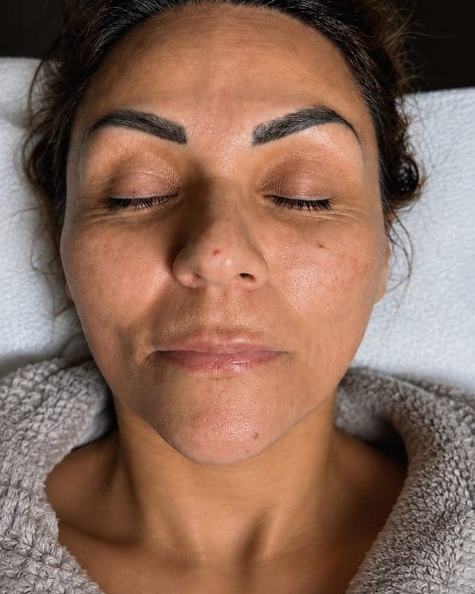 Before: Nano-Infusion